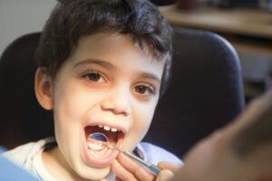 Does your child have a cavity?