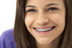 the history of braces
