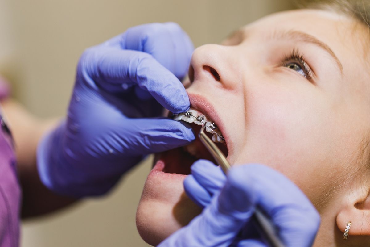 SPEED System™ Braces: Faster Smiles for Kids and Teens in Gilbert, AZ